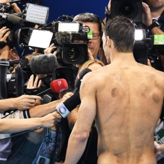 Βεντούζες, αυτή η (ολυμπιακή) μάστιγα;