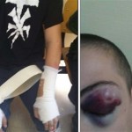 Έρευνα για τον ξυλοδαρμό νεαρών από αστυνομικούς στα Εξάρχεια