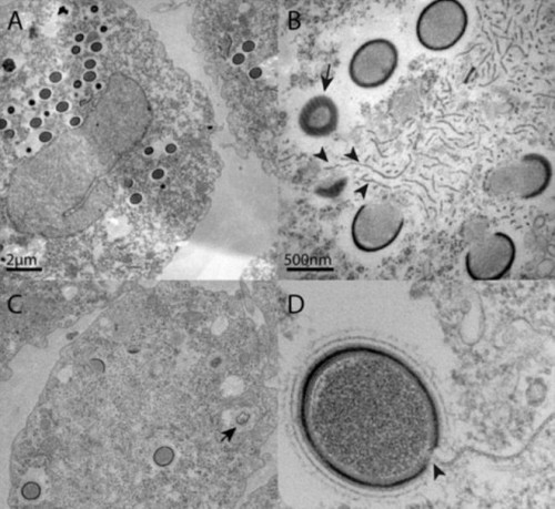 Άγνωστος προϊστορικός ιός βρέθηκε κατεψυγμένος σε γκουλάγκ στη Σιβηρία