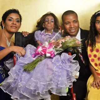 Κολομβία: Γιόρτασε τα 15α της γενέθλια σε σώμα 90χρονης