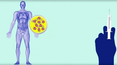 Επαναστατική ανακάλυψη κατά του καρκίνου από επιστήμονες των ΗΠΑ