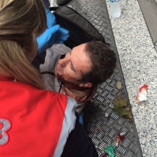 Επίθεση από αγνώστους δέχθηκε ο δημοσιογράφος Δημήτρης Πέρρος