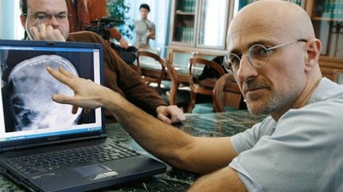 Η πρώτη μεταμόσχευση ανθρώπινου κεφαλιού από Ιταλό νευροχειρουργό σχεδιάζεται για του χρόνου