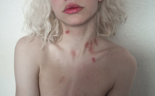 Γιατί οι πιπιλιές θεωρούνται τόσο υποτιμημένες;