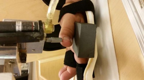 Ακρωτηριασμένοι απέκτησαν ξανά αίσθηση αφής μέσα από το τεχνητό χέρι τους