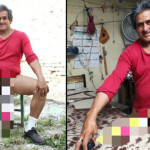 Ο άντρας με το μεγαλύτερο πέος στον κόσμο αρνείται εγχείρηση μείωσής του