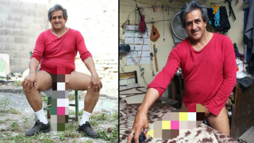 Ο άντρας με το μεγαλύτερο πέος στον κόσμο αρνείται εγχείρηση μείωσής του