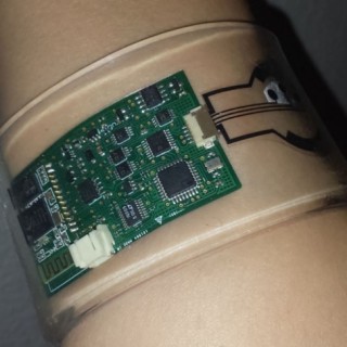 Νέος αισθητήρας ιδρώτα βοηθά στην έγκυρη διάγνωση της κυστικής ίνωσης