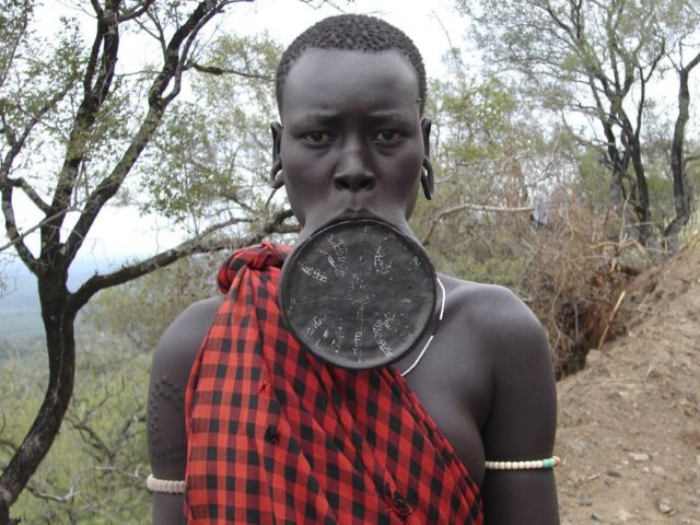 Οι πιο ακραίες αλλαγές στο σώμα που έχετε δει ποτέ