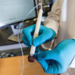 Χειρουργικό «πενάκι» διακρίνει με ακρίβεια τον καρκίνο από τον υγιή ιστό