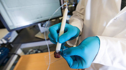 Χειρουργικό «πενάκι» διακρίνει με ακρίβεια τον καρκίνο από τον υγιή ιστό