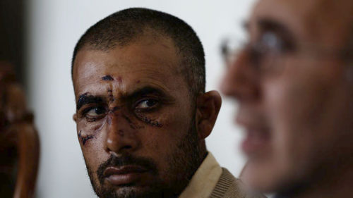 Ετήσιο ρεκόρ οι ρατσιστικές επιθέσεις στον Ασπρόπυργο