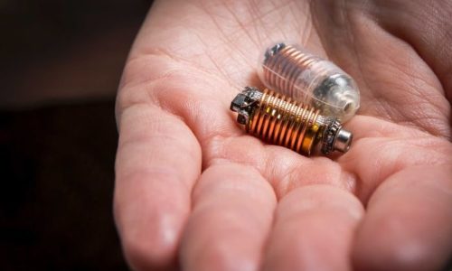 To Black Mirror ξεκινά από το έντερο μας