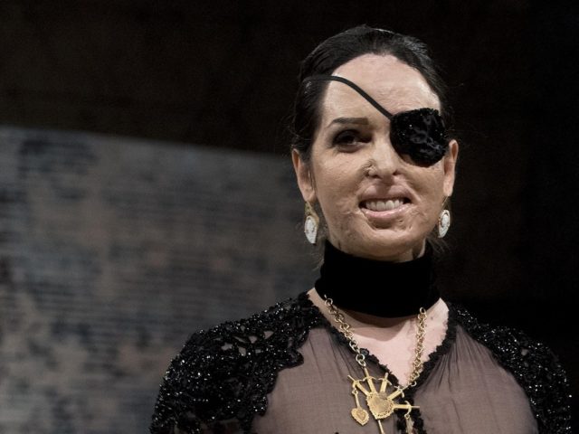 To μήνυμα της Gessica Notaro που έχασε το μάτι της μετά από επίθεση με οξύ [ΒΙΝΤΕΟ]