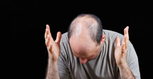 Μια νέα θεραπεία για τη φαλάκρα υπόσχεται ένα φάρμακο για… την οστεοπόρωση