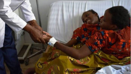 Τανζανία: Σιαμαίες δίδυμες πέθαναν με 15 λεπτά διαφορά σε ηλικία 21 ετών