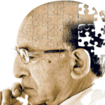 Νέα εξέταση αίματος προβλέπει την έναρξη του Αλτσχάιμερ