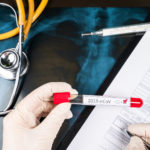 Αναβάλλονται όλες οι εκδρομές των σχολείων στο εξωτερικό, λόγω κορονοϊού