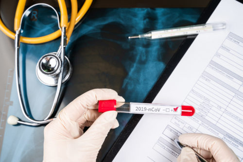 Αναβάλλονται όλες οι εκδρομές των σχολείων στο εξωτερικό, λόγω κορονοϊού