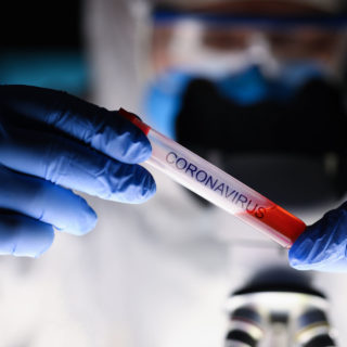 Πόσος καιρός θα χρειαστεί για το εμβόλιο κατά του κορονοϊού;