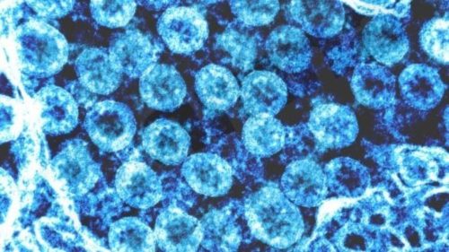 Βραζιλιάνος ασθενής φαίνεται να είναι ο πρώτος στον κόσμο που θεραπεύθηκε από τον ιό HIV μόνο με φάρμακα