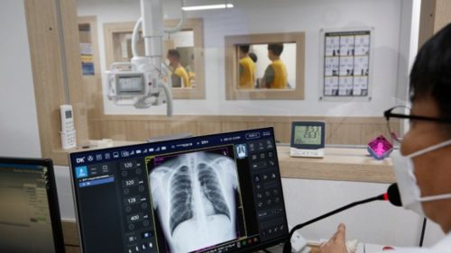 Κορωνοϊός: Μειώνεται ο ημερήσιος αριθμός των νεκρών σε πολλές χώρες