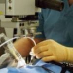 Η πανδημία ακυρώνει εκατομμύρια χειρουργεία παγκοσμίως