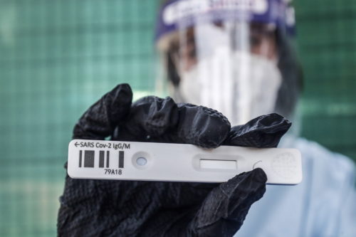 Κορωνοϊός: Οι άνθρωποι με ομάδα αίματος Ο έχουν -κατά μέσο όρο- 12% μικρότερη πιθανότητα να μολυνθούν από