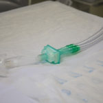 Κορωνοϊός: Αποσωληνώθηκε 17χρονη ύστερα από 40 μέρες στη ΜΕΘ