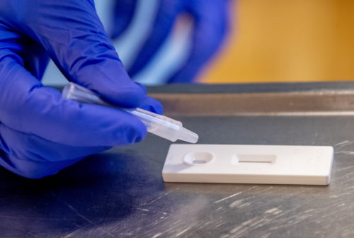 Πού θα γίνουν δωρεάν rapid test την Παρασκευή 9 Ιουλίου