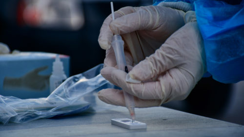 Πού μπορείτε να κάνετε δωρεάν rapid test σήμερα Τετάρτη