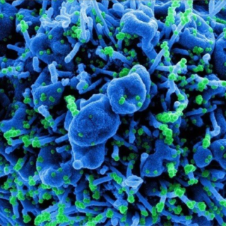 Ο κίνδυνος θανάτου από Covid-19 είναι τουλάχιστον τριπλάσιος σε σχέση με τη γρίπη