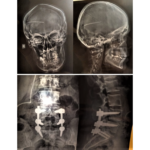 Επείγουσα έκκληση οικονομικής υποστήριξης νεαρής γυναίκας και ανήλικης κόρης