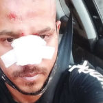 Άγριο, ρατσιστικό ξύλο σε νεαρό στη Ναύπακτο