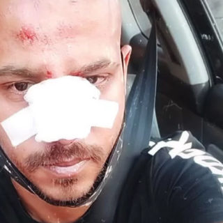 Άγριο, ρατσιστικό ξύλο σε νεαρό στη Ναύπακτο