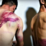 Αφγανιστάν: Οι Ταλιμπάν συνέλαβαν και ξυλοκόπησαν άγρια δημοσιογράφους- Σκληρές εικόνες