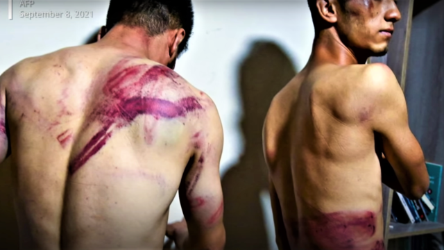 Αφγανιστάν: Οι Ταλιμπάν συνέλαβαν και ξυλοκόπησαν άγρια δημοσιογράφους- Σκληρές εικόνες