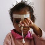 Δέκα χιλιάδες παιδιά έχουν σκοτωθεί ή τραυματιστεί από την αρχή του πολέμου στην Υεμένη