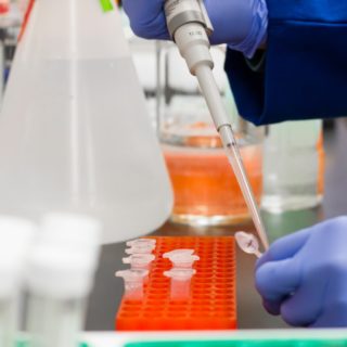 Ασφαλής και όχι μολυσματική η μεταμόσχευση οργάνων από θνήσκοντες ασθενείς με Covid-19