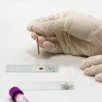 Νέο τεστ αίματος προβλέπει τον κίνδυνο εμφράγματος και εγκεφαλικού με αυξημένη ακρίβεια