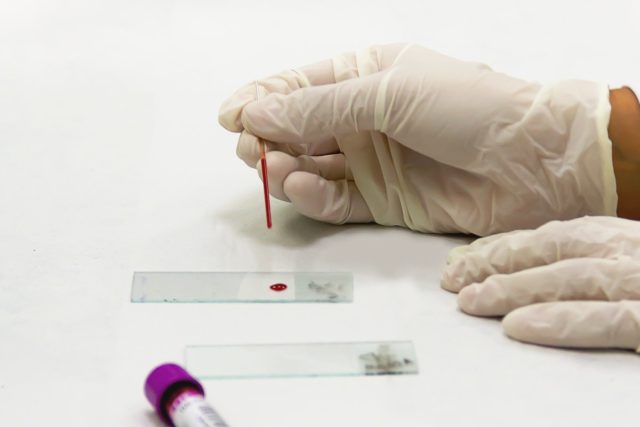 Νέο τεστ αίματος προβλέπει τον κίνδυνο εμφράγματος και εγκεφαλικού με αυξημένη ακρίβεια