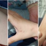 Άρτα: Μητέρα καταγγέλλει ότι η διευθύντρια του σχολείου δάγκωσε το AMEA παιδί της