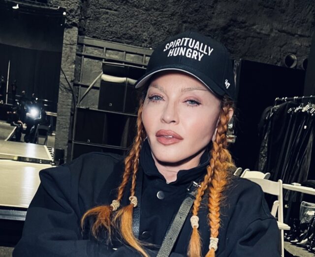 Η Μαντόνα τρολάρει τους επικριτές της: «Κοιτάξτε πόσο χαριτωμένη είμαι τώρα που έφυγε το πρήξιμο από την επέμβαση»