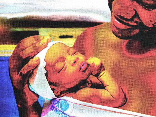 Φροντίδα καγκουρό: Η αγκαλιά που σώζει τη ζωή πρόωρων βρεφών