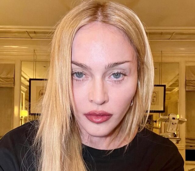 «Ένιωσα την αγάπη σας» – Η πρώτη ανάρτηση της Μαντόνα μετά την νοσηλεία της