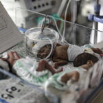 Γάζα-Πρόωρα βρέφη: «Ήταν σε τρομακτική κατάσταση όταν έφθασαν εδώ»