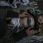 Γάζα: Με οξύ υποσιτισμό 12.000 παιδιά κάτω των πέντε ετών