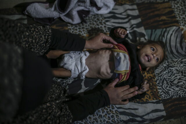 Γάζα: Με οξύ υποσιτισμό 12.000 παιδιά κάτω των πέντε ετών