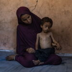 MSF: Ένα στα τέσσερα παιδιά στη Γάζα υποσιτίζεται