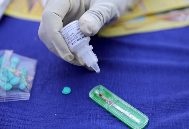 Παγκόσμια Ημέρα κατά του AIDS: Το στίγμα, η πρόληψη και η νέα πραγματικότητα των ανθρώπων με HIV